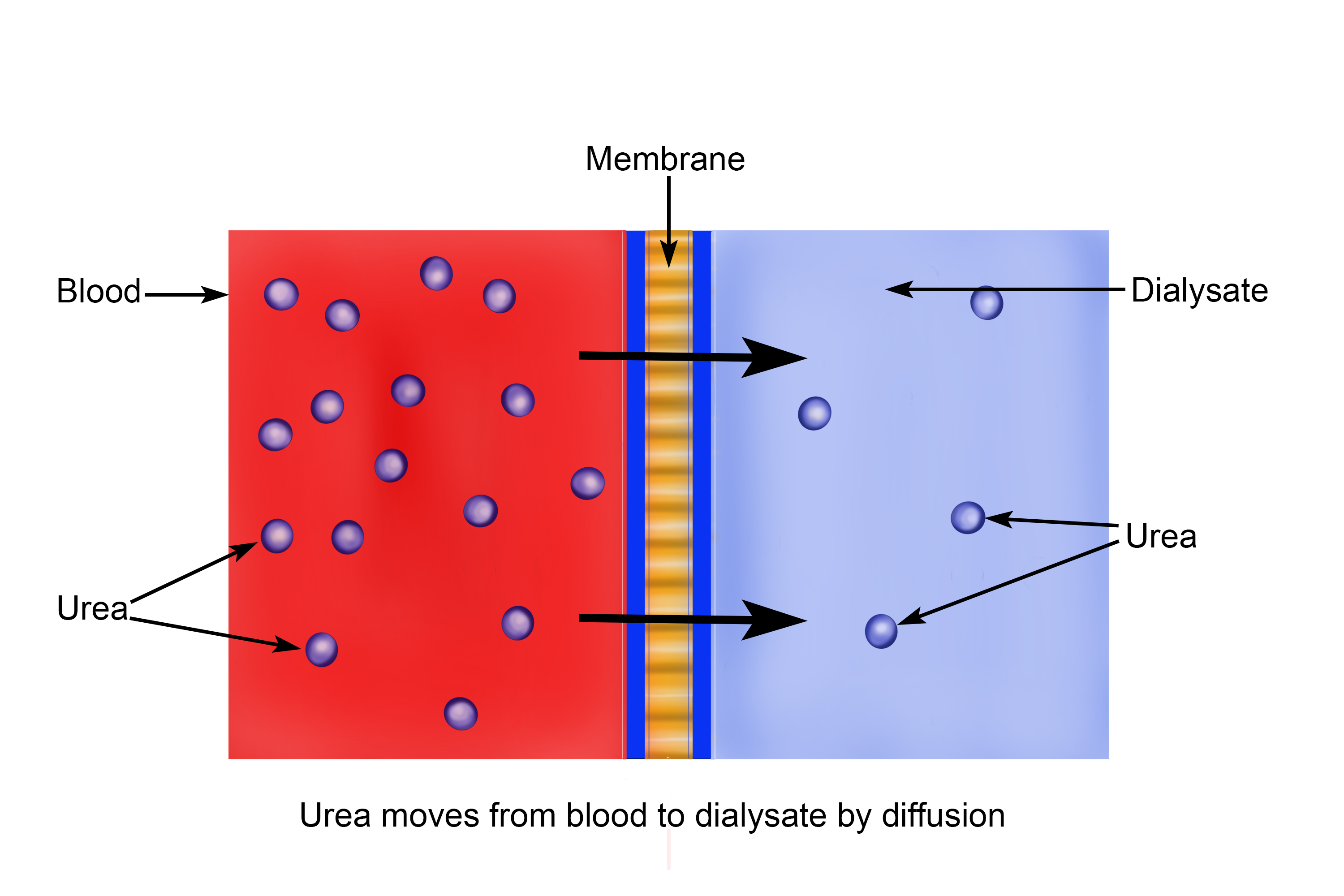 Dialysate is passed close the  blood stream with membrane that only lets urea pass through it, because of the concentration gradient, urea passes through the membrane by diffusion